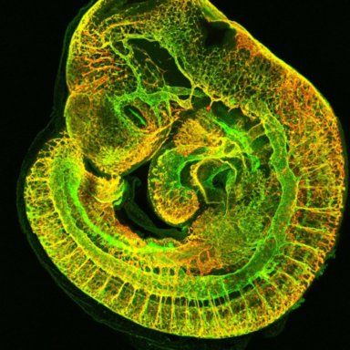 ICH&GOS Imaging Facility - Confocal, Multiphoton and Widefield imaging